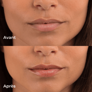 Baume lèvres teinté